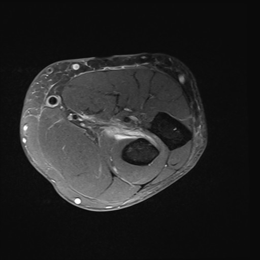 Click on the Serie image to view the images of Wieszt, Gnter